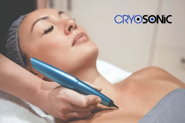 Cryosonic lesion removal prices book today! High Wycombe