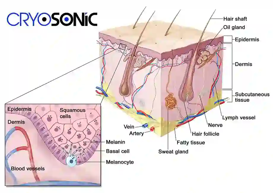 How Cryotherapy Stimulates Melanocyte Activity  High Wycombe